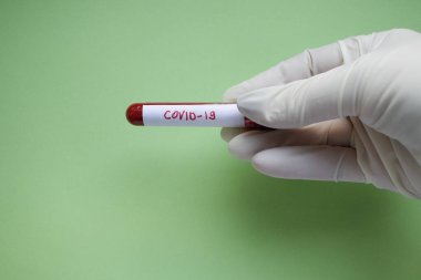 Tek kullanımlık tıbbi eldiven, içinde koronavirüs testi olan bir tüp taşır.