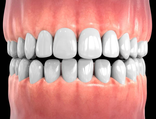 Dentes isolados em 3D. Tooths Conceito de Assistência Odontológica — Fotografia de Stock