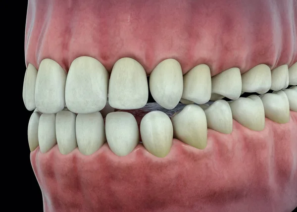 Dentes isolados em 3D. Tooths Conceito de Assistência Odontológica — Fotografia de Stock