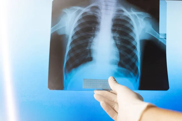 Doctor Examines Ray Photograph Hospital — Stock Photo, Image