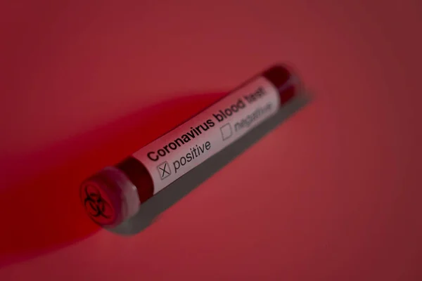 Primer Plano Prueba Sangre Positiva Del Coronavirus Con Etiqueta Riesgo — Foto de Stock