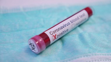 Yeşil tıbbi maske üzerinde Coronavirus kan testi, yakın çekim. Konsept: COVID-2019 virüs koruması, virüs yaymayı bırakın, koronavirüs salgını
