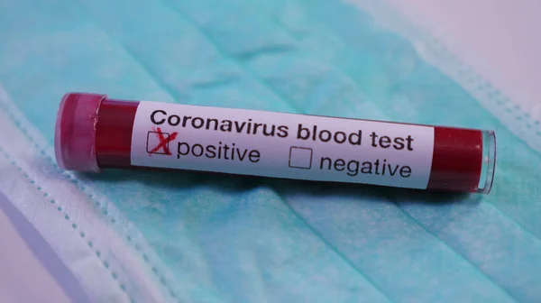 Exame Sangue Coronavírus Com Máscara Médica Verde Perto Conceito Proteção Imagem De Stock