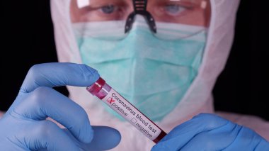Profesyonel beyaz güvenlik üniformalı adam, biyotehlike etiketli pozitif Coronavirus kan testi yapan test tüpünü izliyor ve gösteriyor. Covid-19 salgını. Dünya salgını.