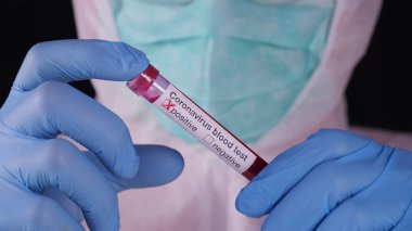 Silezya, Polonya, 3 Nisan 2020: Coronavirus salgını, Polonya Ambulans Servisi sağlık personeli ve karavan kurbanların cesetlerini alıyor. Bulaşıcı hastalıklar hastanesi. Avrupa 'da Covid-19 salgını.