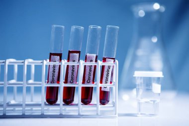 Laboratuvarda Coronavirus hastalığı (COVID-19) kan örneği bulundu. Virüs örneği laboratuvarda. Doktor yeni virüsü test ediyor. 