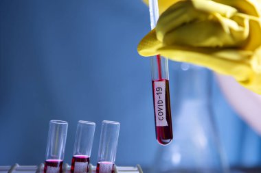 Laboratuvarda Coronavirus hastalığı (COVID-19) kan örneği bulundu. Virüs örneği laboratuvarda. Doktor yeni virüsü test ediyor. 