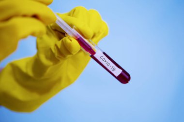 Laboratuvarda Coronavirus hastalığı (COVID-19) kan örneği bulundu. Virüs örneği laboratuvarda. Doktor yeni virüsü test ediyor. 