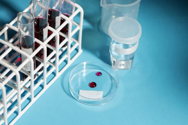 Laboratuvarda Coronavirus hastalığı (COVID-19) kan örneği bulundu. Virüs örneği laboratuvarda. Doktor yeni virüsü test ediyor. 