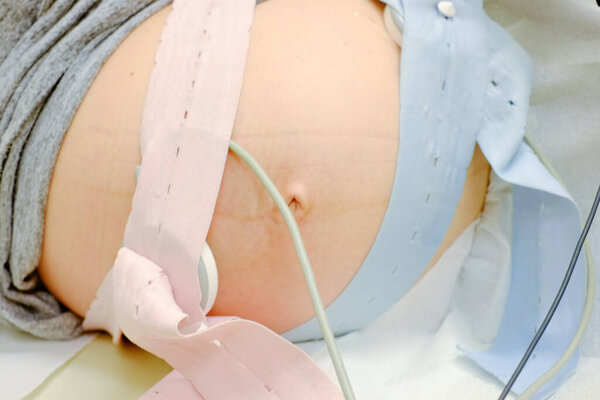 Женщина в офисе доктора Уит КТГ или ЭКГ. Беременность в больнице
. 