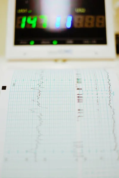 Doktor Whit CTG ya da EKG 'deki kadın. Hastanede Ctg hamileliği.. 
