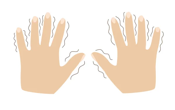 様々な精神疾患の症状の手の中に震え パニック パーキンソン病 爪で手 白い線で区切られた平らなベクトル図 — ストックベクタ