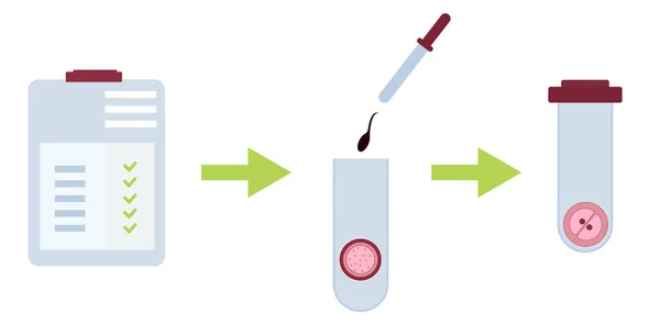 Vitro Termékenyítési Protokoll Szakaszai Lapos Eredmények Jók Majd Spermiumok Petesejtek — Stock Vector