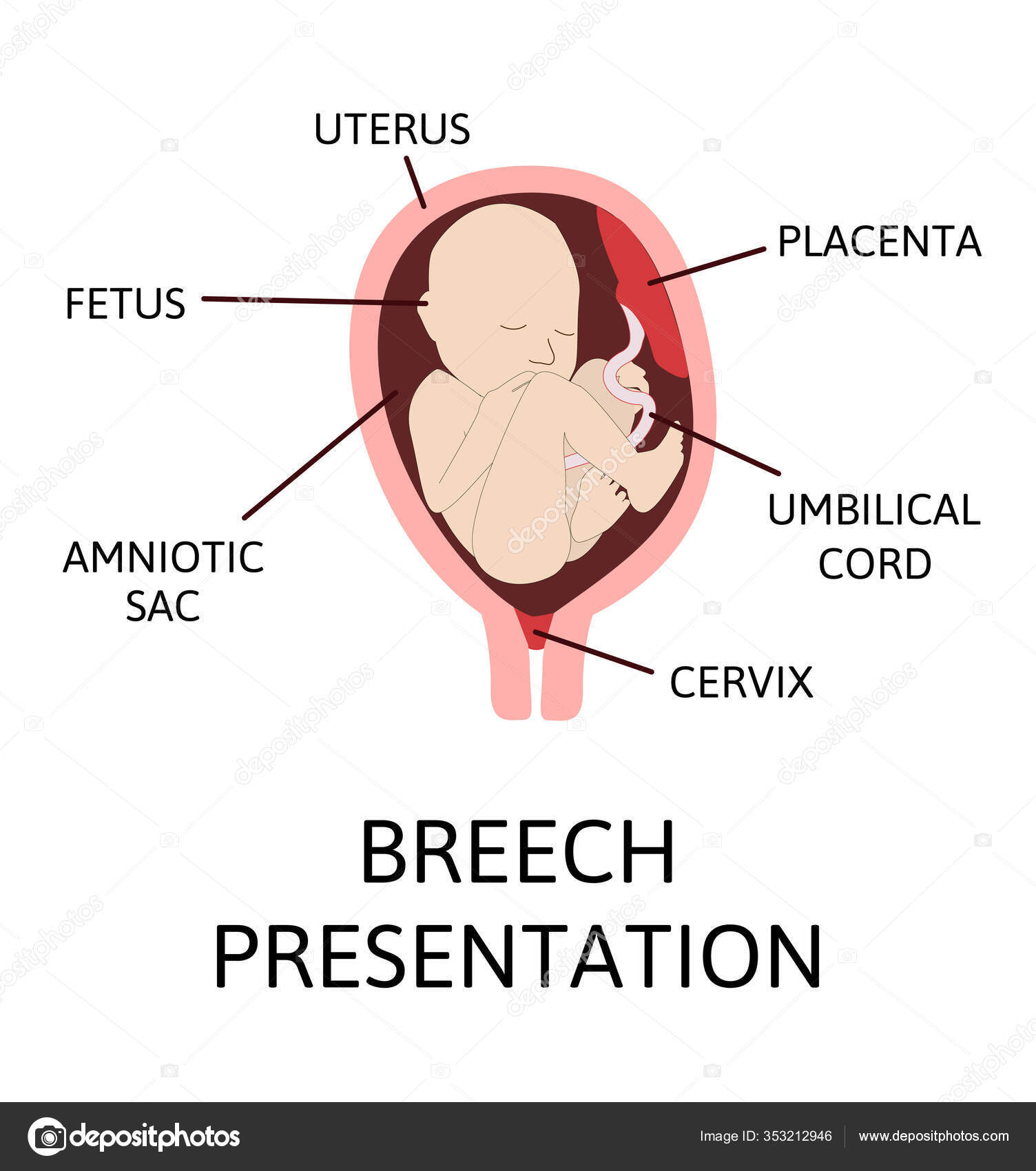 Different Baby Positions Uterus Pregnancy Cephalic Breech Transverse  Oblique Lies Stock Vector Image by ©Betty1994 #353212946