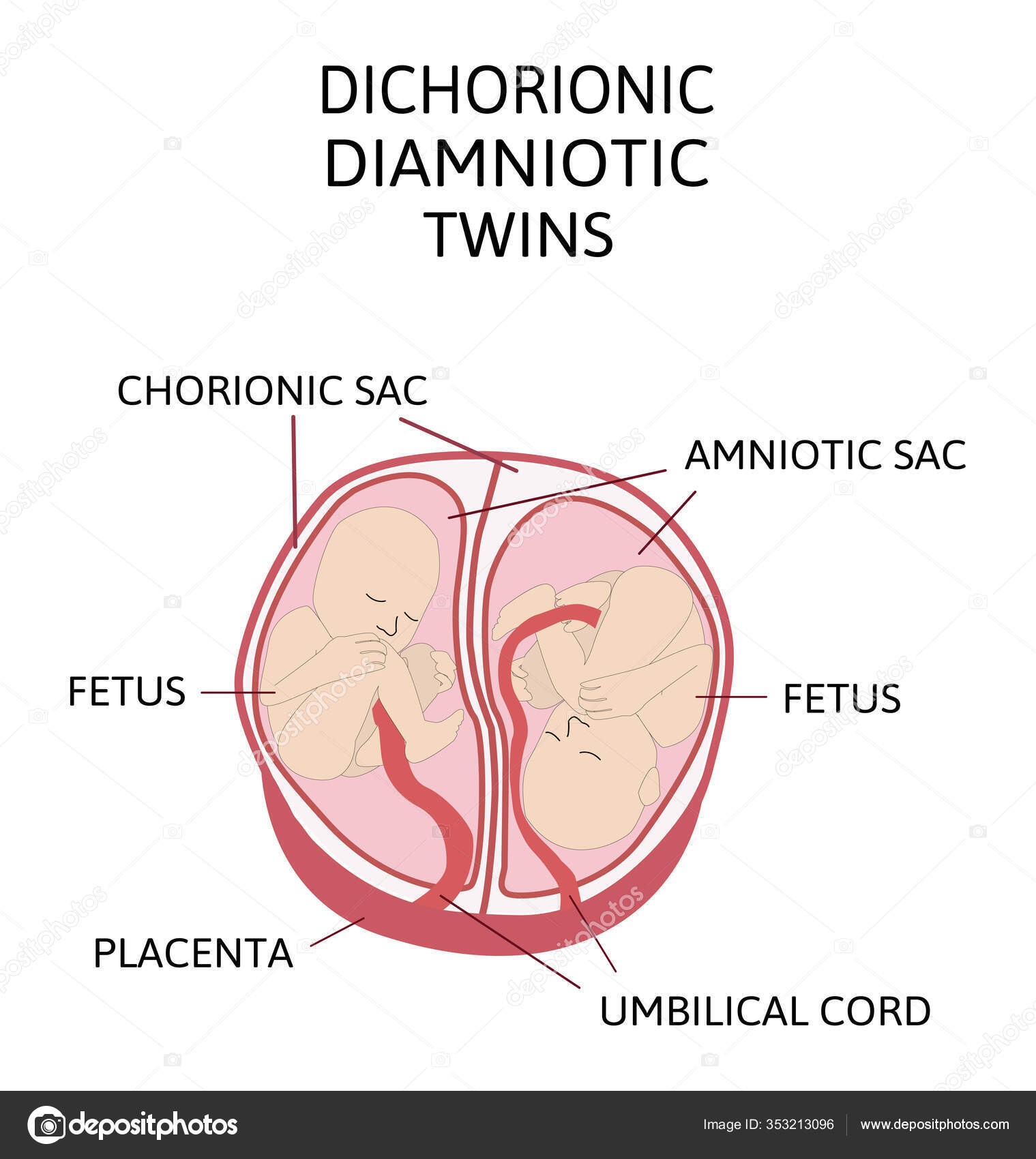 Anatomy Abdomen Twins Twin Types Infographic Elements Flat Design