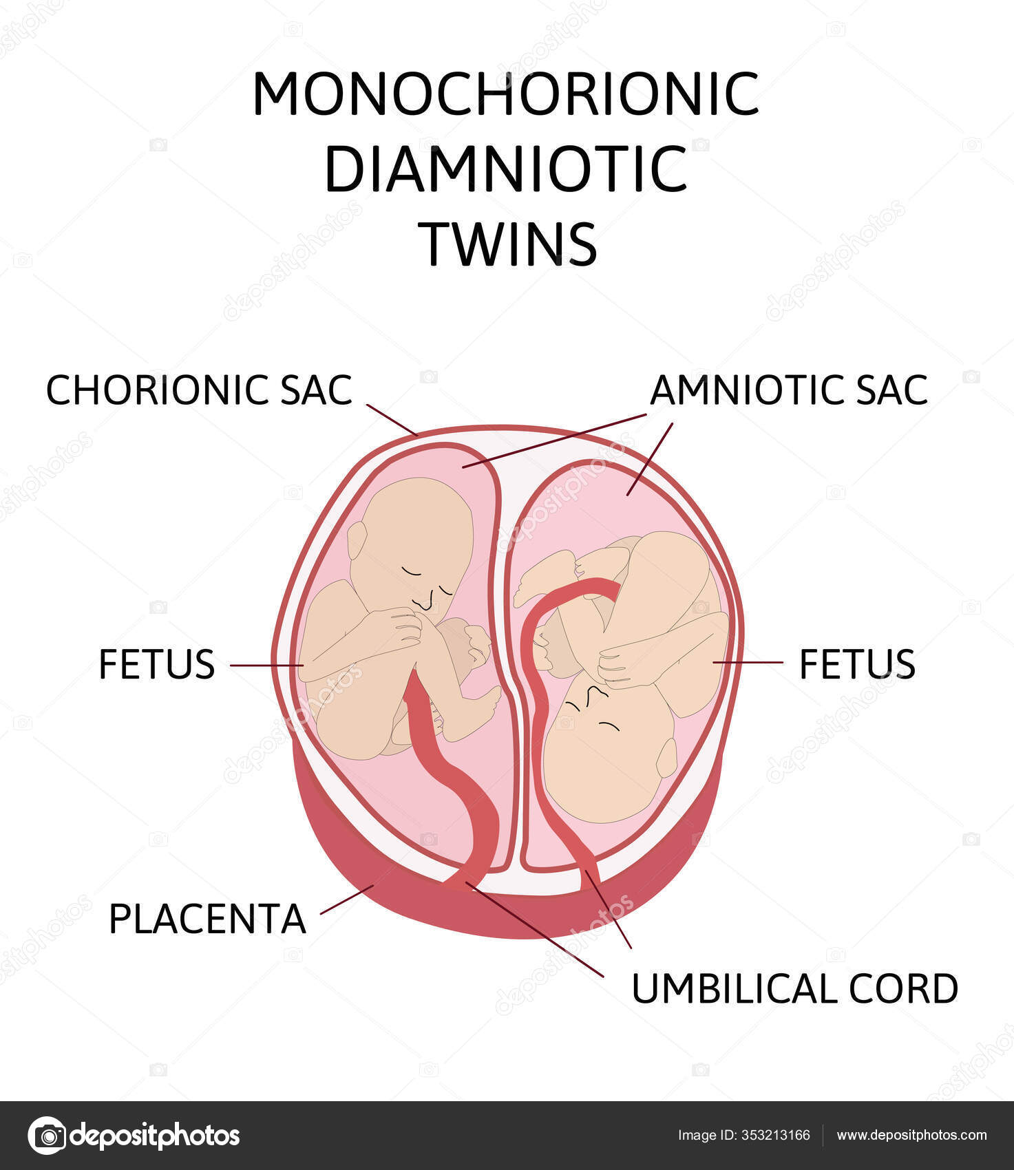 Anatomia Abdômen Com Gêmeos Tipos Gêmeos Elementos Infográficos Design  Plano Vetor de ©Betty1994 353213166, image size:1473x1700