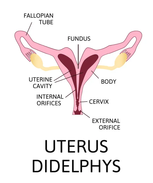 Forma Del Útero Órgano Reproductor Femenino Útero Unicornio Con Cuerno — Vector de stock