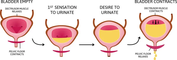 Hogy működik a húgyhólyag. a húgyhólyag izmok összehúzódnak, míg a záróizom ellazul. — Stock Vector