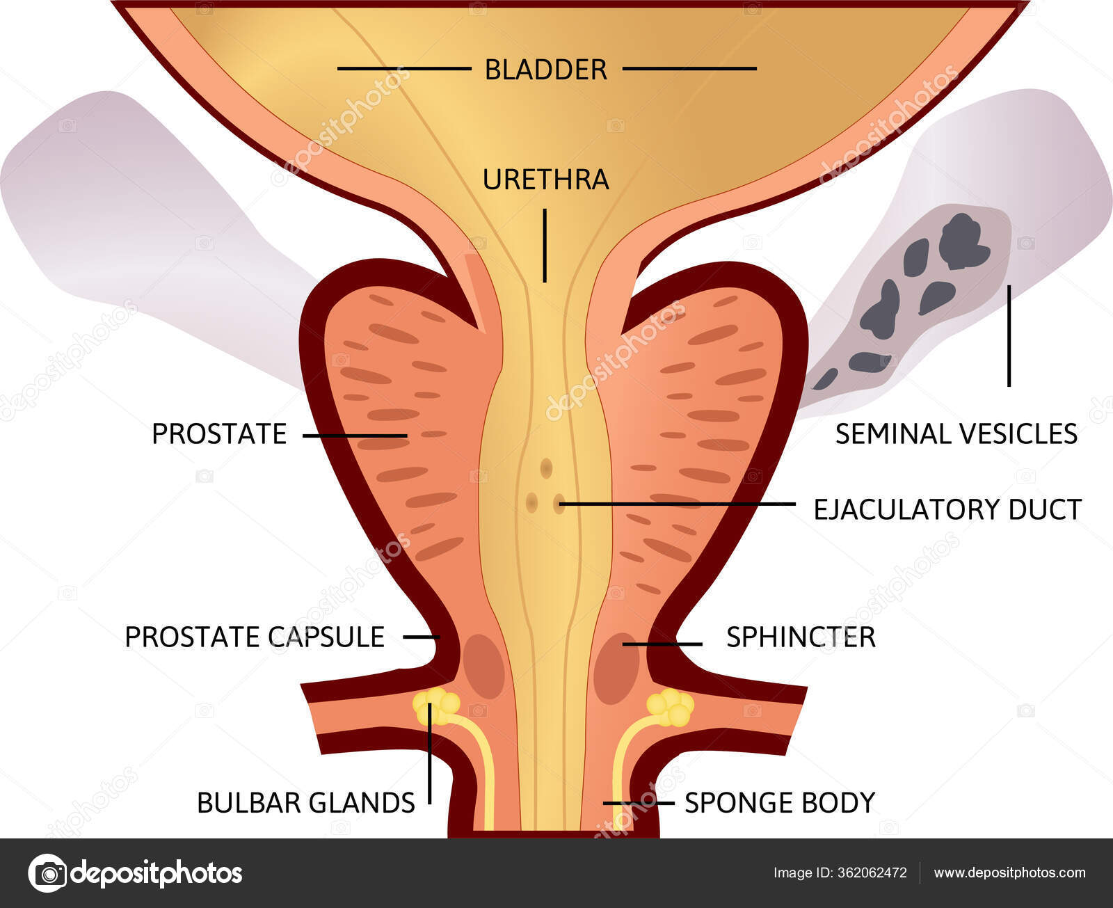 Prostatitis rendszerek. Mi mit jelent a prosztatarák patológiai leletén?