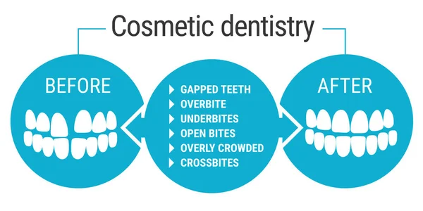 Odontologia estética antes depois —  Vetores de Stock