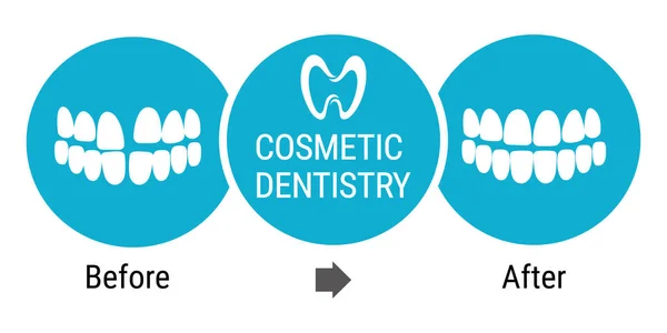 Cosmetic dentistry before after — Stock Vector