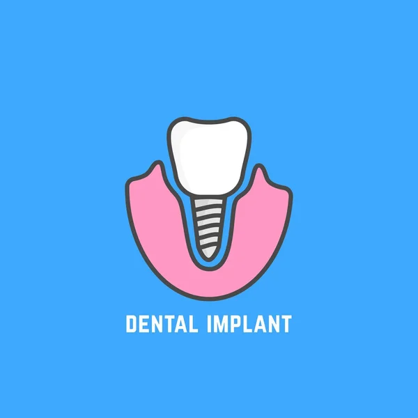 Ícone simples de implante dental branco —  Vetores de Stock