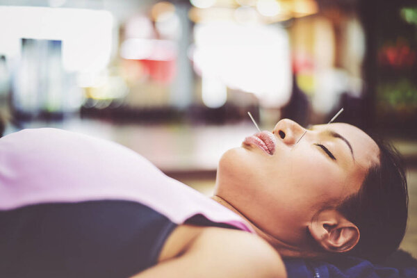 In selective focus to blurred of hand performing acupuncture therapy on customer 's face.Cross processing and Split tone new colour trend like process
.