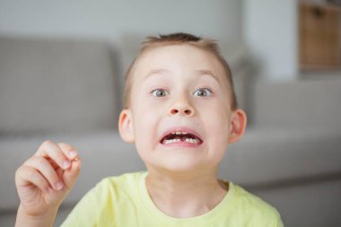 Çocuk ilk süt dişini düşürdü. Mutlu küçük çocuk ve süt dişi.