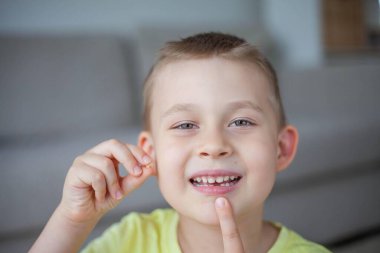 Çocuk ilk süt dişini düşürdü. Mutlu küçük çocuk ve süt dişi.