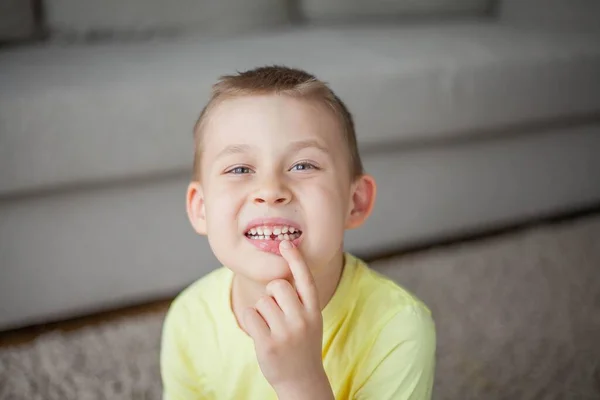 Dziecko upuściło pierwszy ząb mleka. Szczęśliwy chłopczyk i mleczny ząb. — Zdjęcie stockowe