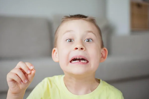 Dítě upadlo první mléčný zub. Šťastný chlapeček a mléčný zub. — Stock fotografie