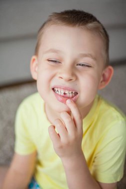 Çocuk ilk süt dişini düşürdü. Mutlu küçük çocuk ve süt dişi. Çocuk..