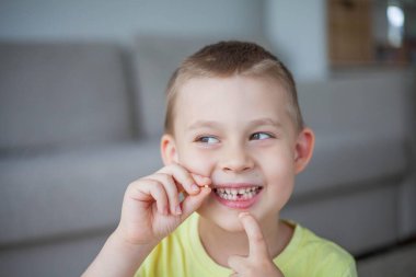Çocuk ilk süt dişini düşürdü. Mutlu küçük çocuk ve süt dişi. Çocuk..