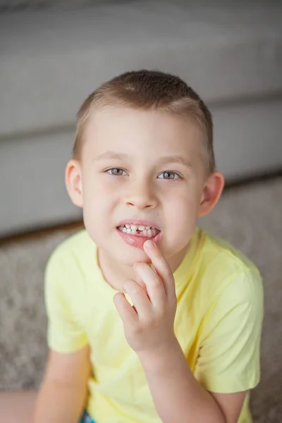 Criança Deixou Cair Primeiro Dente Leite Rapazinho Feliz Dente Leite — Fotografia de Stock