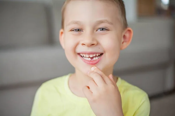 Criança Deixou Cair Primeiro Dente Leite Rapazinho Feliz Dente Leite — Fotografia de Stock