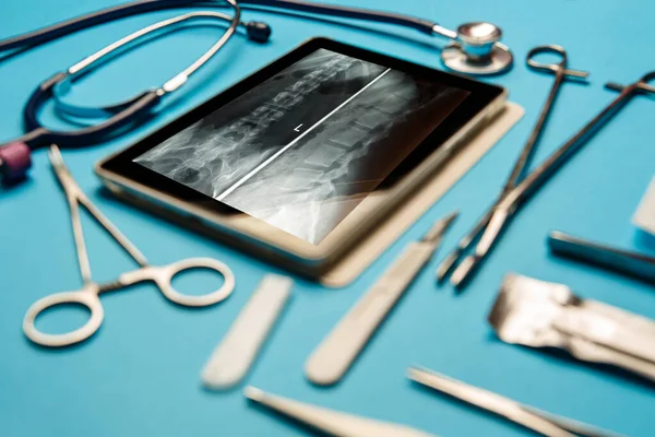 태블릿 도구들 파란색 표면에 있습니다 의학적 — 스톡 사진