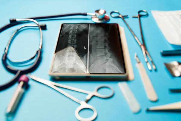 태블릿 도구들 파란색 표면에 있습니다 의학적 — 스톡 사진