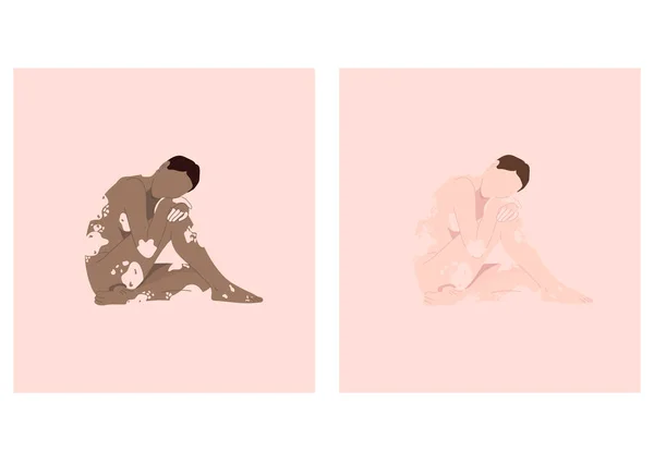 Vitiligo Violation Couleur Peau Illustration Vectorielle — Image vectorielle