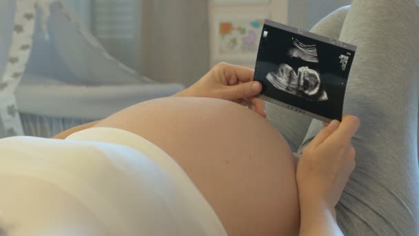 Ecografía del abdomen, nueve meses de embarazo — Vídeo de stock