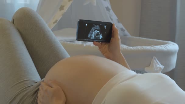 Ultrasound exam in the hands of a future mother. — Stock videók