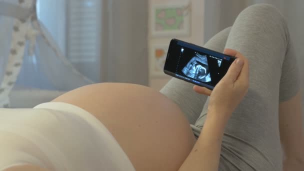 Ultraschalluntersuchung des Fötus in den Händen einer Schwangeren — Stockvideo