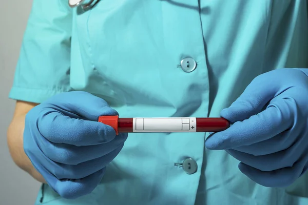 Nurse Protective Suit Holds Positive Blood Test Result New Rapidly — Stock Photo, Image