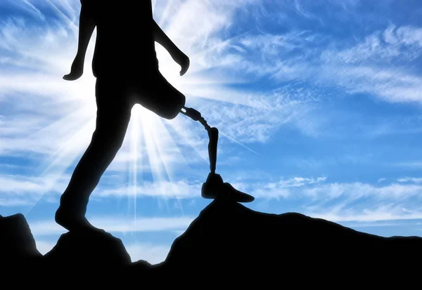 Концепция инвалидности, протезирование ноги — стоковое фото
