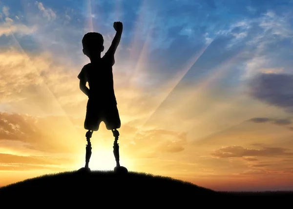 Щасливий хлопчик з інвалідністю з протезною ногою, що стоїть зверху — стокове фото