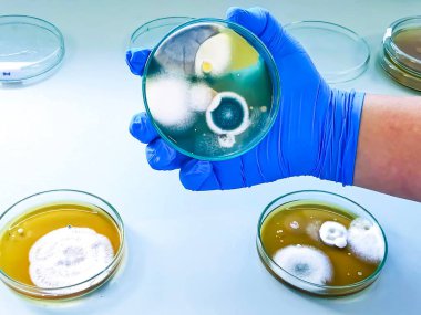 Malt Extract Agar in Petri dish using for growth media to isolate and cultivate yeasts, molds and fungal testing from clinical samples, hold in scientist hand in medical health laboratory. clipart