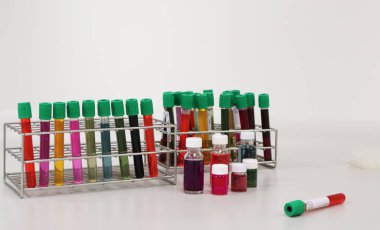 Tüp mikrobiyoloji laboratuvarında Coronavirus (COVID-19) klinik deney aşamasını engellemek için yapılan aşı testleri ya da araştırmaları, hastalıkların yayılmasına neden olan antivirüs için kan reaktifi deneyi.