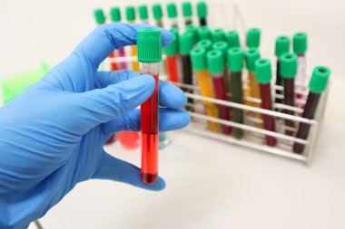 Kırmızı kan çözücü ya da çözeltisi olan hücre kültürü tüpü ellerinde nitril mavisi eldivenler, yeşil kapaklı renkli hücre tüpleri ve anti-virüs için biyoteknoloji analiz deneyleri giyerler..