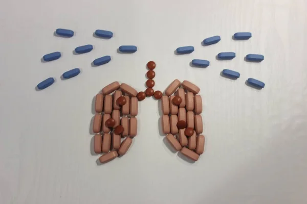ベージュの錠剤は肺の形でレイアウトされています 肺炎の治療 白で単離された青とベージュの錠剤 — ストック写真