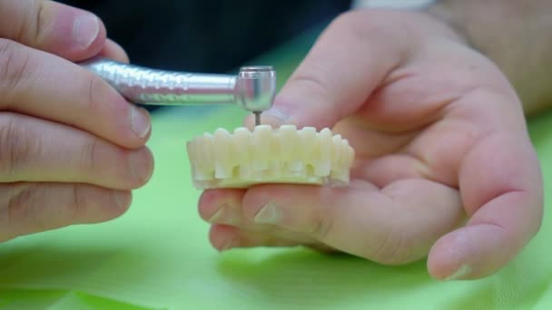 Technicien Dentaire Établit Cadre Pour Les Implants Gros Plan — Video