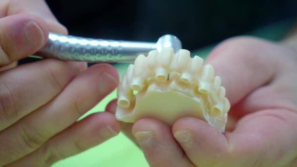 Technik Dentystyczny Tworzy Ramy Dla Implantów Zbliżenie — Wideo stockowe